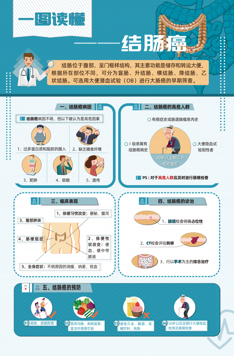 一圖讀懂——結(jié)腸癌（加）